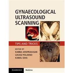 Gynaecological Ultrasound Scanning (Häftad, 2020)