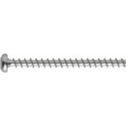 NKT 150262 Woodscrew 200st