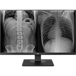 LG 27HJ713C-B Clinical Review