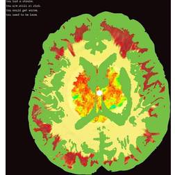 Minus 5 Stroke Manor (Vinyl)