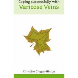 Coping Successfully with Varicose Veins