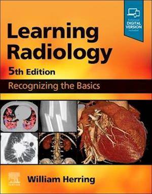 Learning Radiology (Häftad)