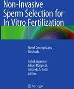 Sperm Non-Invasive Sperm Selection for In Vitro Fertilization: Bog, Paperback softback, Engelsk
