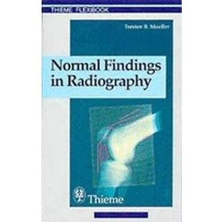 Normal Findings in Radiography