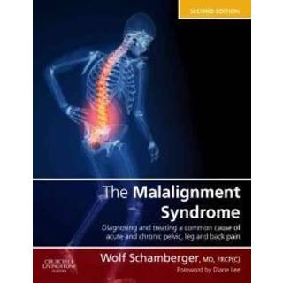 The Malalignment Syndrome