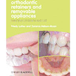Orthodontic Retainers and Removable Appliances