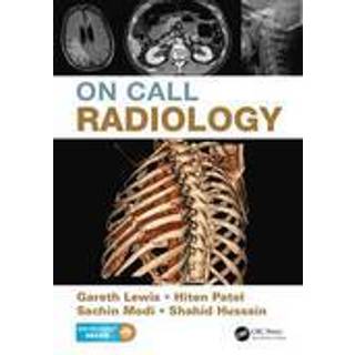 On Call Radiology