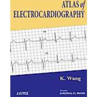 Atlas of Electrocardiography