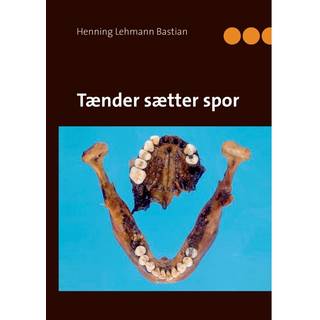 Tænder sætter spor