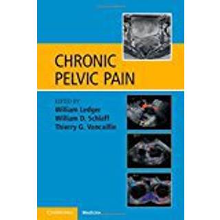 Chronic Pelvic Pain