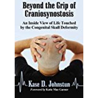 Beyond the Grip of Craniosynostosis