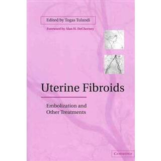 Uterine Fibroids