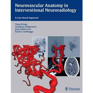Neurovascular Anatomy in Interventional Neuroradiology