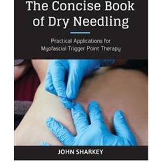 The Concise Book of Dry Needling