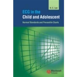 ECG in the Child and Adolescent