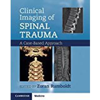 Clinical Imaging of Spinal Trauma