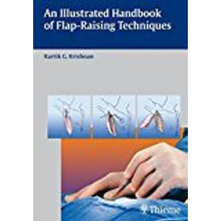 An Illustrated Handbook of Flap-Raising Techniques