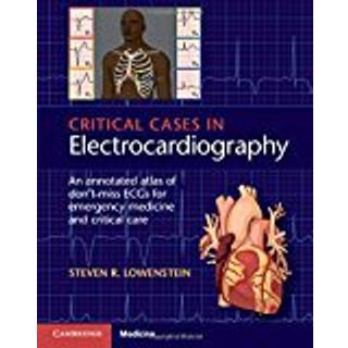 Critical Cases in Electrocardiography