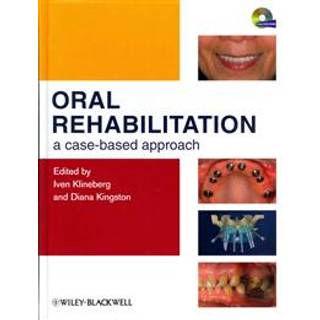 Oral Rehabilitation