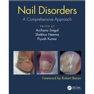 Nail Disorders