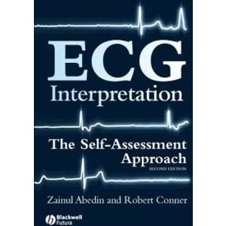 ECG Interpretation