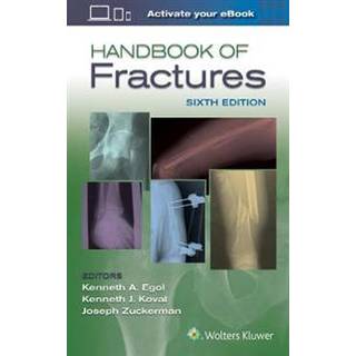 Handbook of Fractures