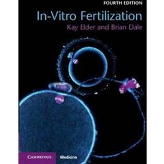 In-Vitro Fertilization