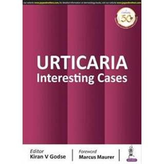 Urticaria