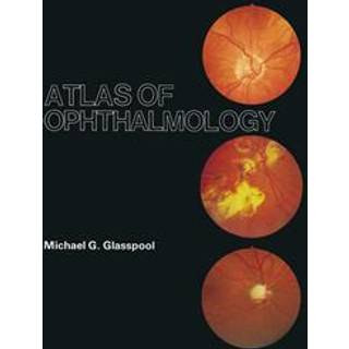 Atlas of Ophthalmology