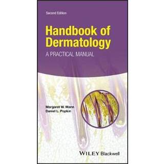 Handbook of Dermatology