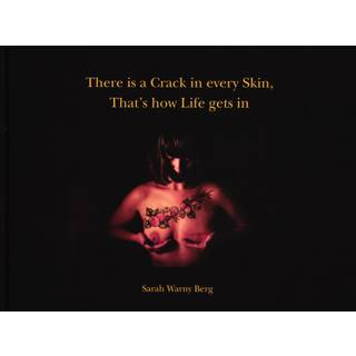 There is a Crack in ever Skin, That's how Life gets in