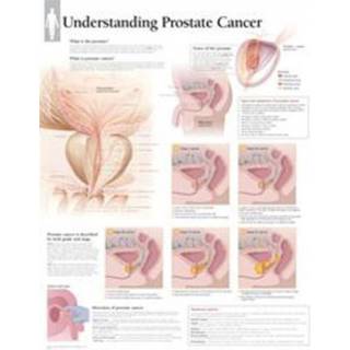 Understanding Prostate Cancer Paper Poster (Wallchart, Engelsk)