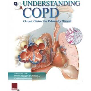 Understanding COPD Flip Chart