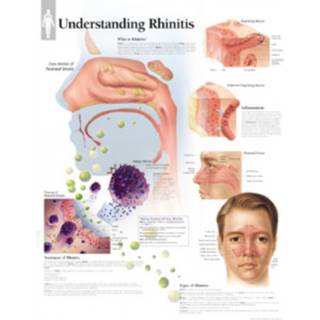 Understanding Rhinitis Laminated Poster (Poster, Engelsk)