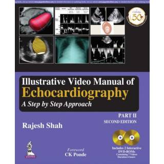 Illustrative Video Manual of Echocardiography