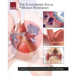 Illustrated Atlas of Human Pathology
