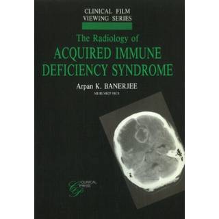 Radiology of Acquired Immune Deficiency Syndrome