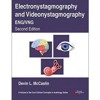 Electronystagmography/Videonystagmography (ENG/VNG)