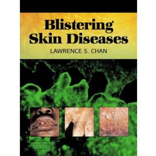 Blistering Skin Diseases