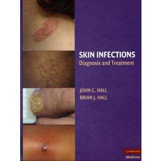 Skin Infections