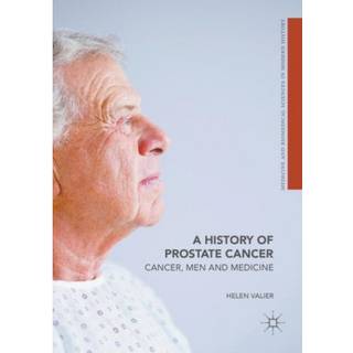 A History of Prostate Cancer (4, 2021) | Helen Valier