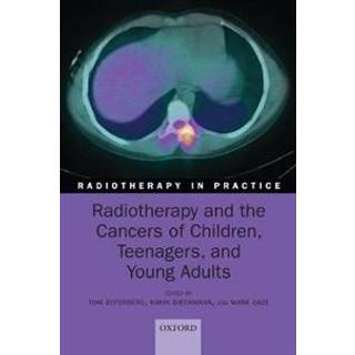 Radiotherapy and the Cancers of Children, Teenagers, and Young Adults