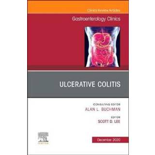 Ulcerative Colitis, An Issue of Gastroenterology Clinics of North America