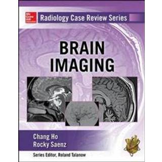 Radiology Case Review Series: Brain Imaging