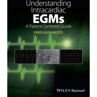 Understanding Intracardiac EGMs