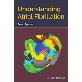 Understanding Atrial Fibrillation
