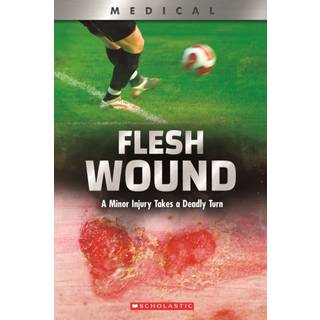 Flesh Wound: A Minor Injury Takes a Deadly Turn (XBooks)