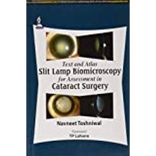 Text and Atlas: Slit Lamp Biomicroscopy for Assessment in Cataract Surgery