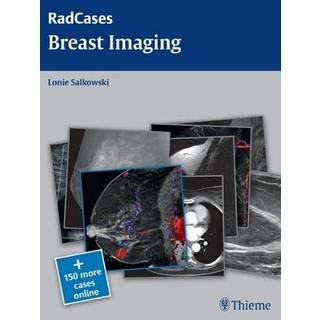 Radcases Breast Imaging