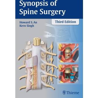 Synopsis of Spine Surgery